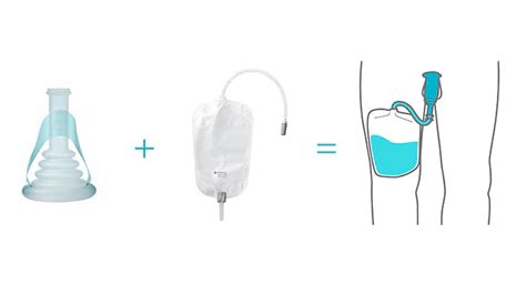 conveen sheath sizes|Coloplast Conveen Instructions For Use